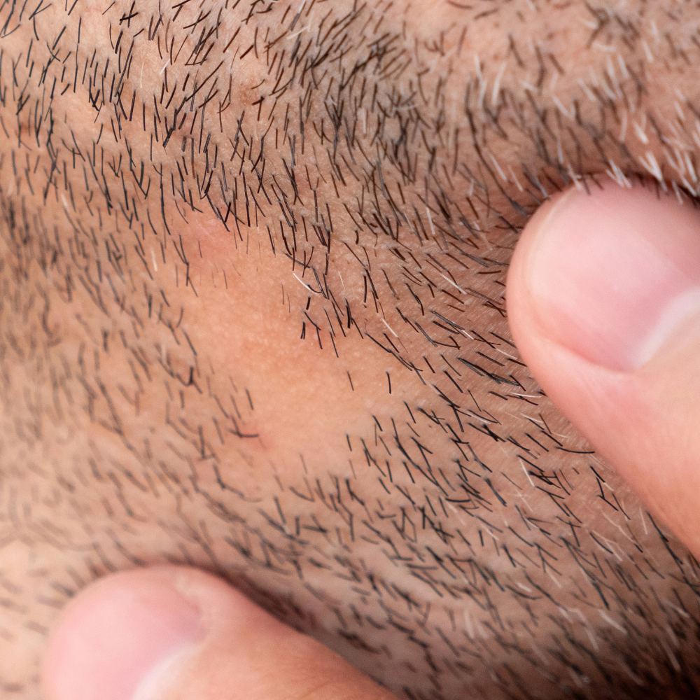 Dissatisfied With Your Patchy Facial Hair? You Might Want to Read This